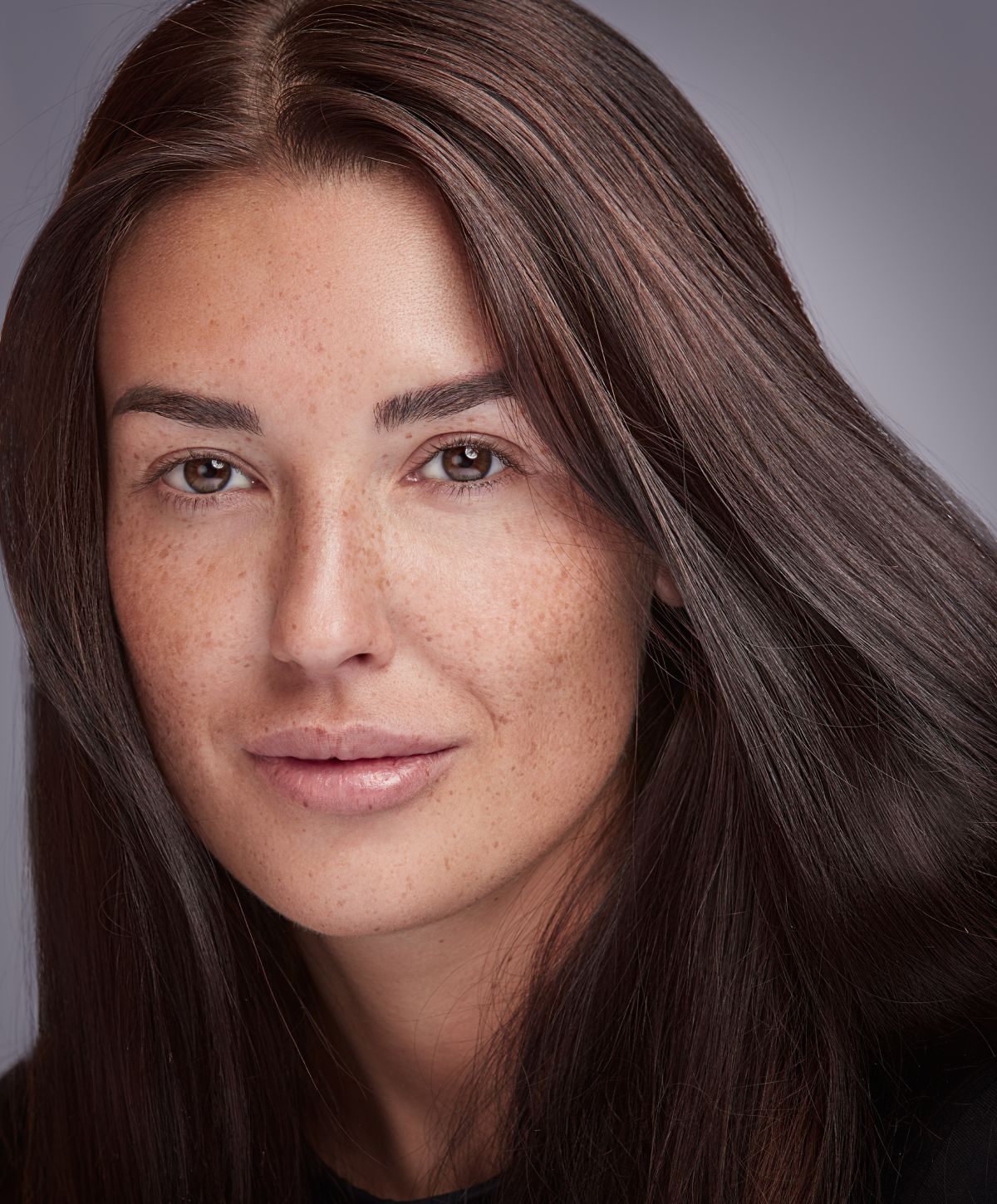 Dedham Botox model close-up of face