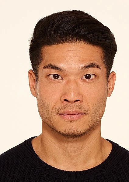 Botox Gallery Before & After