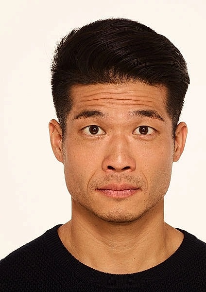 Botox Gallery Before & After