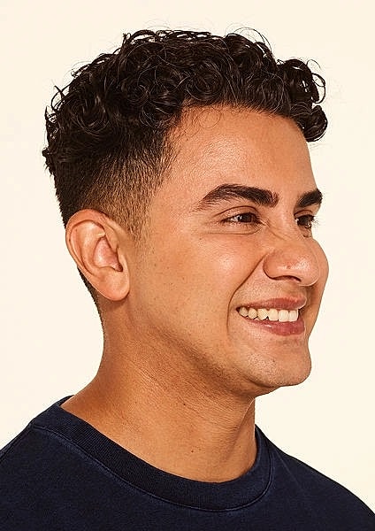 Botox Gallery Before & After