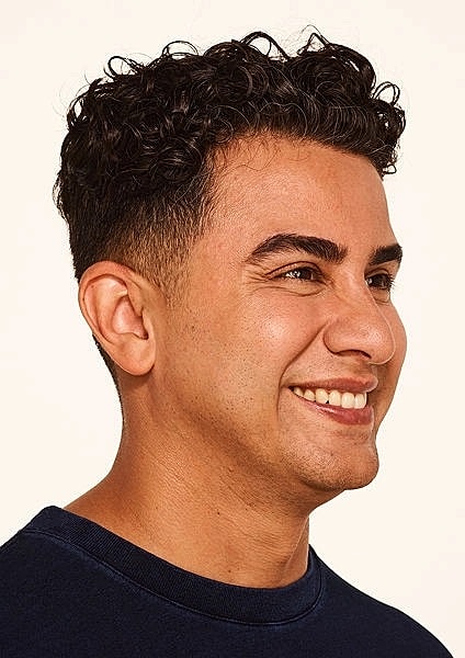 Botox Gallery Before & After