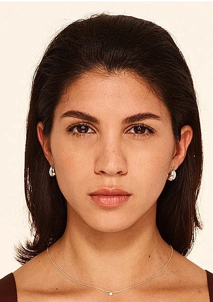 Botox Gallery Before & After