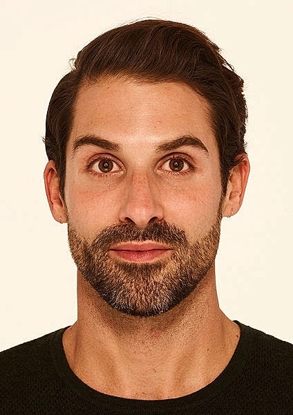 Botox Gallery Before & After