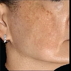 Sylfirm X Gallery Before & After