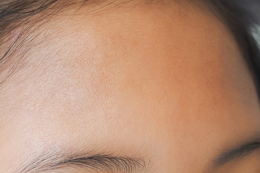 Sylfirm X Gallery Before & After