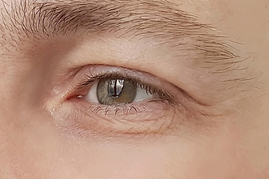 Sylfirm X Gallery Before & After