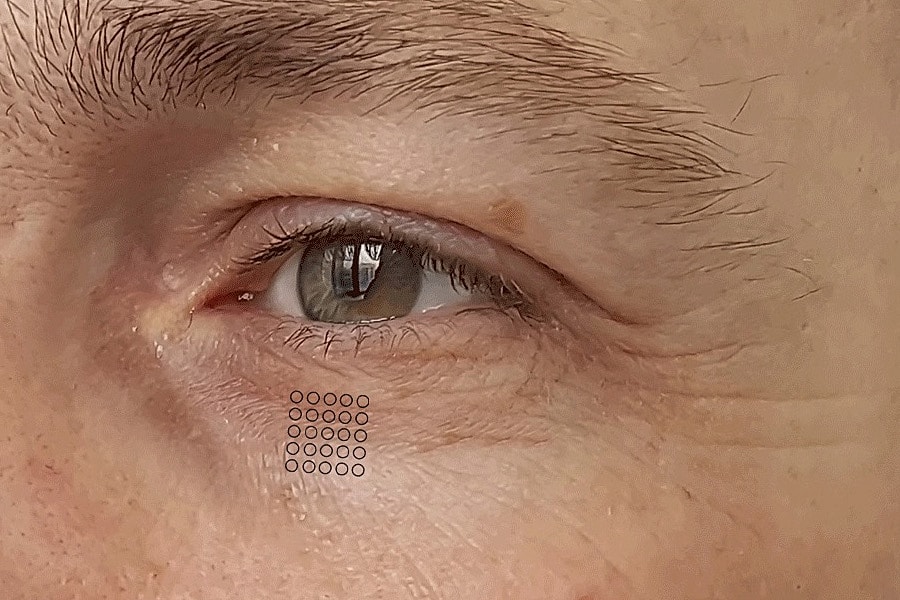 Sylfirm X Gallery Before & After