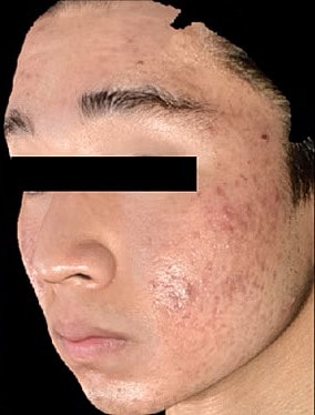 Sylfirm X Gallery Before & After