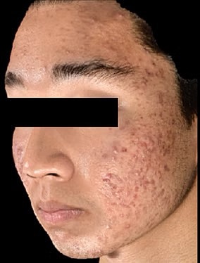 Sylfirm X Gallery Before & After