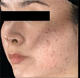 Sylfirm X Gallery Before & After