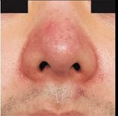 Sylfirm X Gallery Before & After