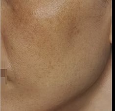 Sylfirm X Gallery Before & After