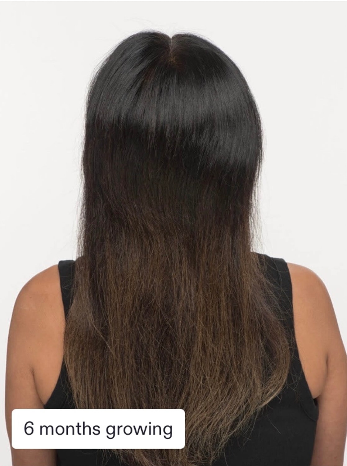 Nutrafol Gallery Before & After