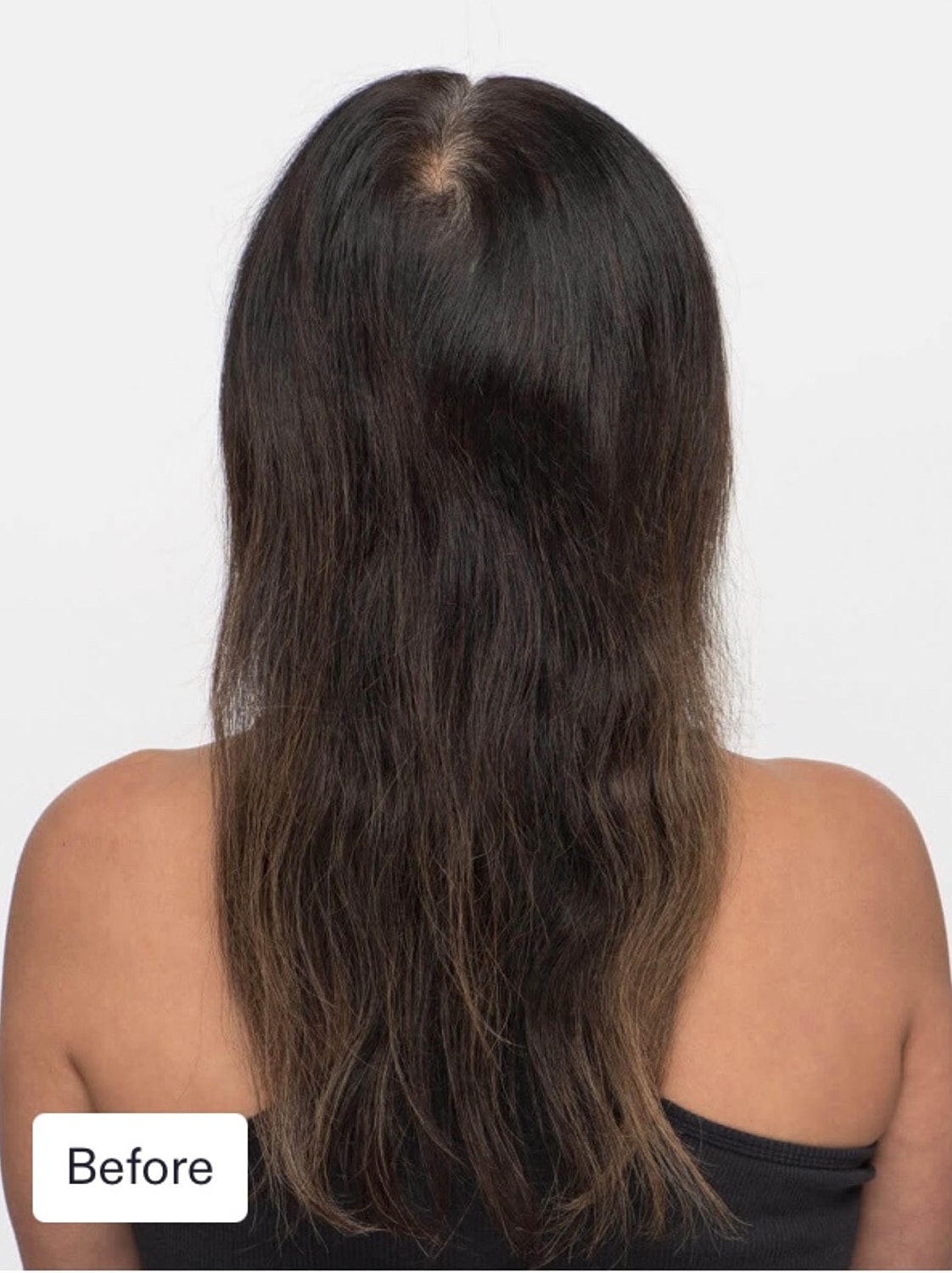 Nutrafol Gallery Before & After