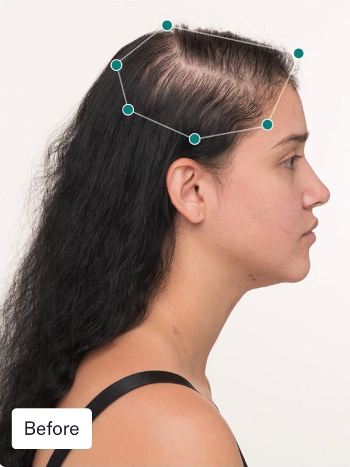 Nutrafol Gallery Before & After